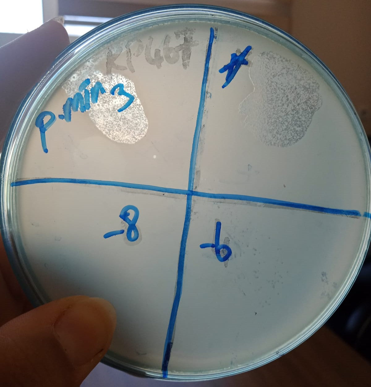 Proteus mirabilis bacteriophage 200036A