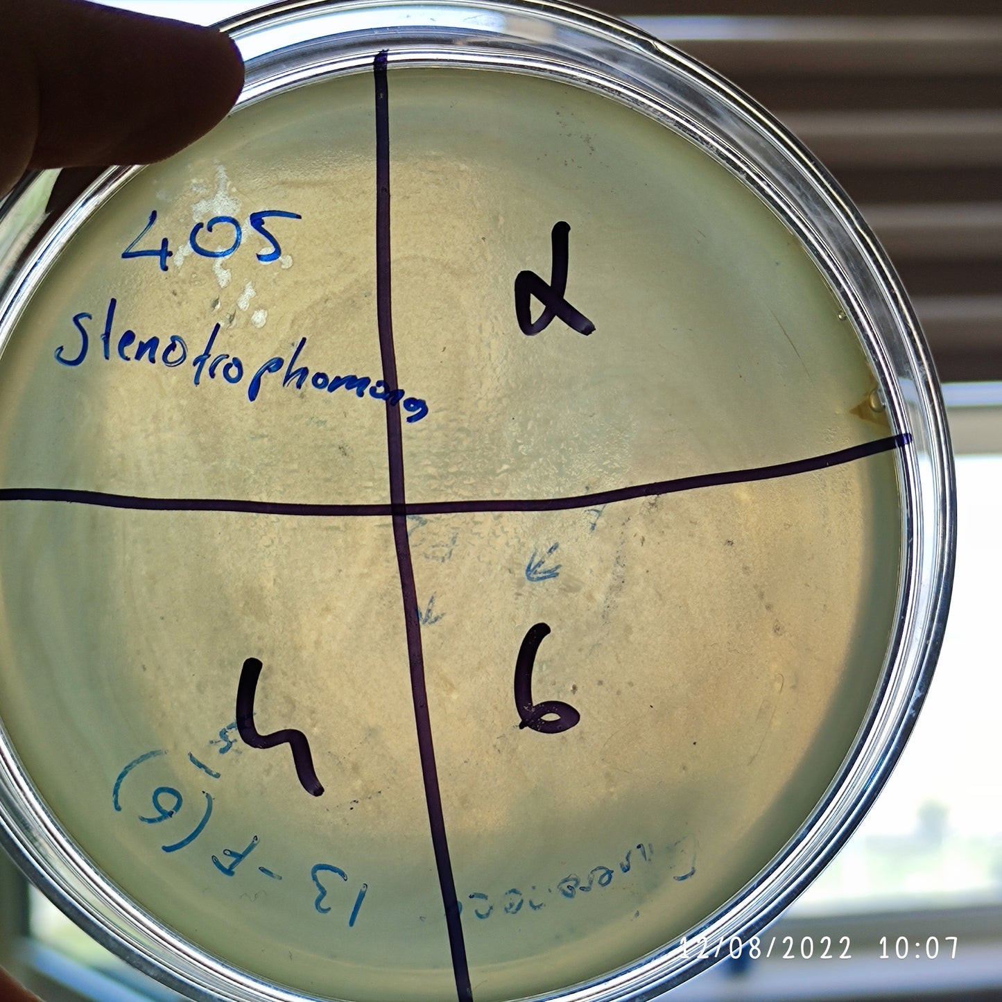 Stenotrophomonas maltophilia bacteriophage 200405F