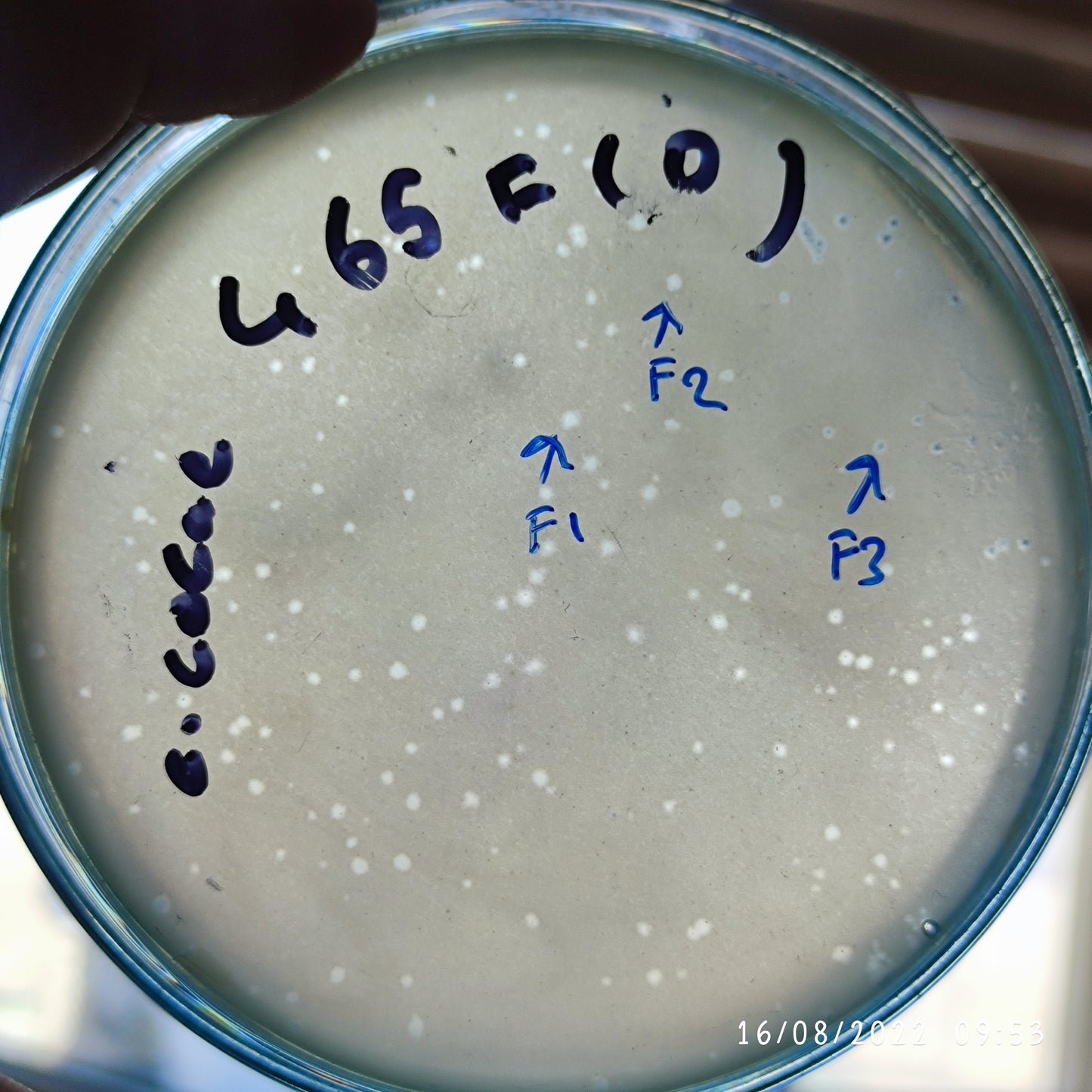 Enterobacter cloacae bacteriophage 2002465F