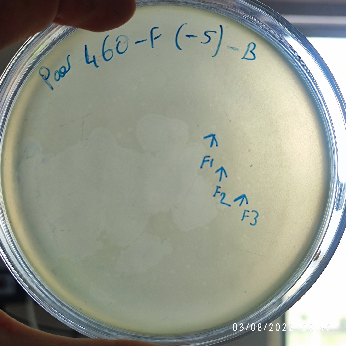 Pseudomonas aeruginosa bacteriophage 130460F