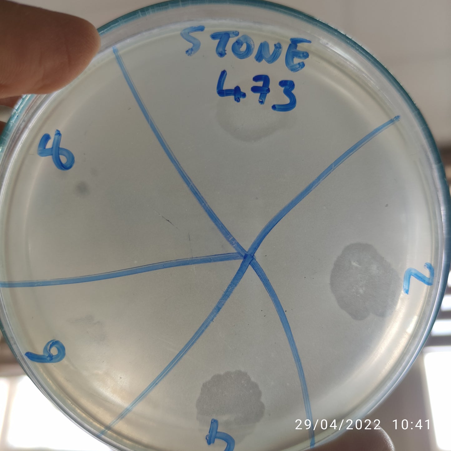 Stenotrophomonas maltophilia bacteriophage 200473D