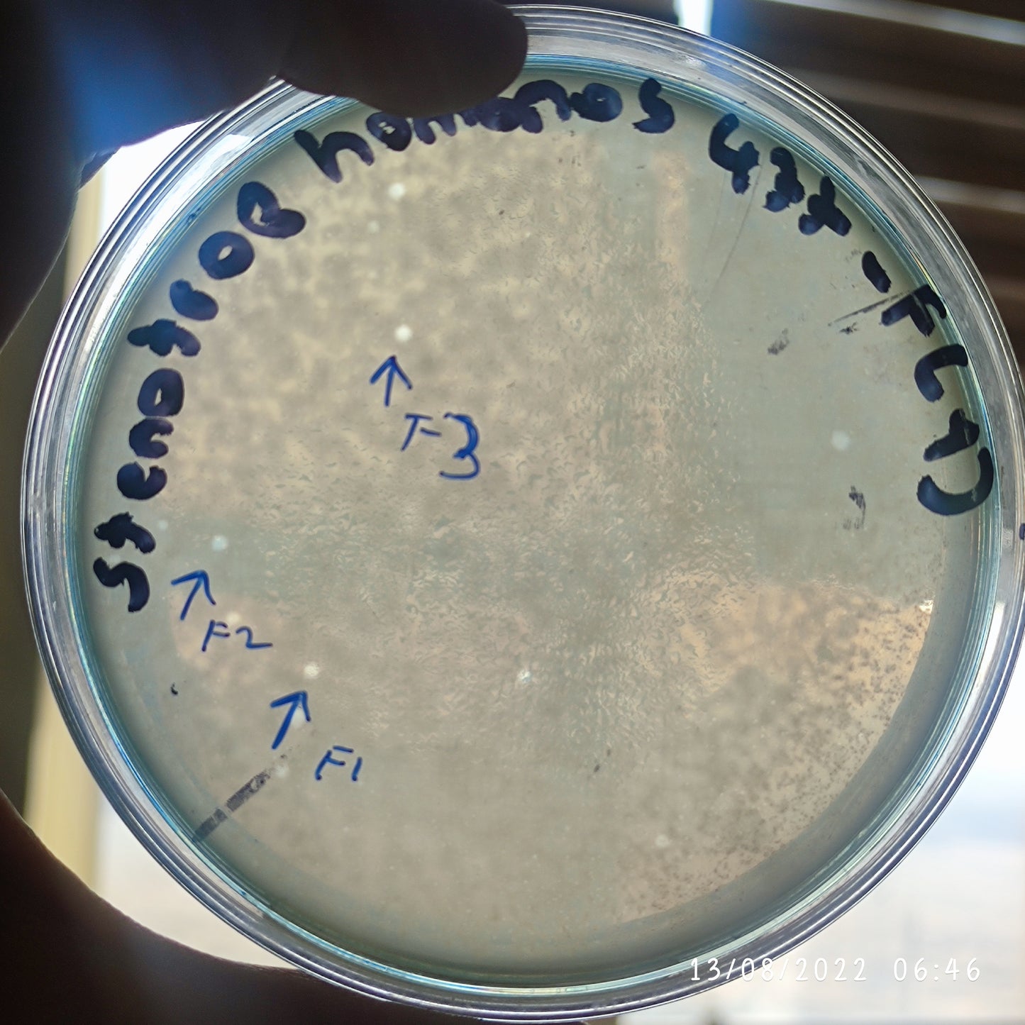 Stenotrophomonas maltophilia bacteriophage 200477F