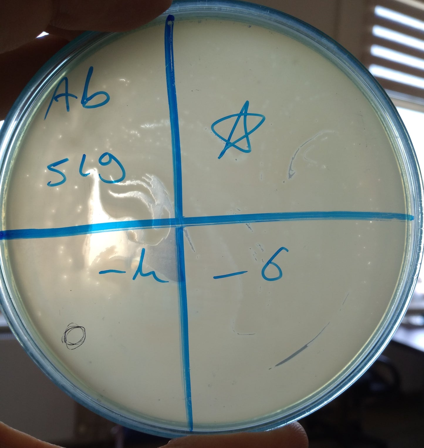 Acinetobacter baumannii bacteriophage 120519A