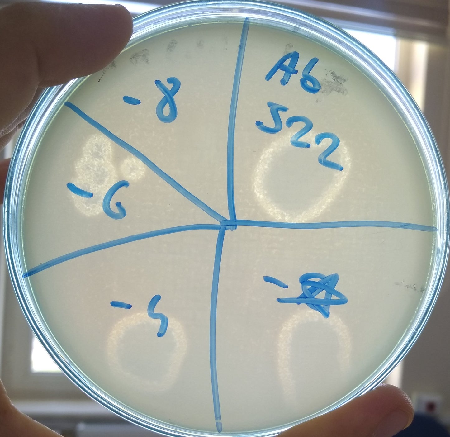 Acinetobacter baumannii bacteriophage 120522A