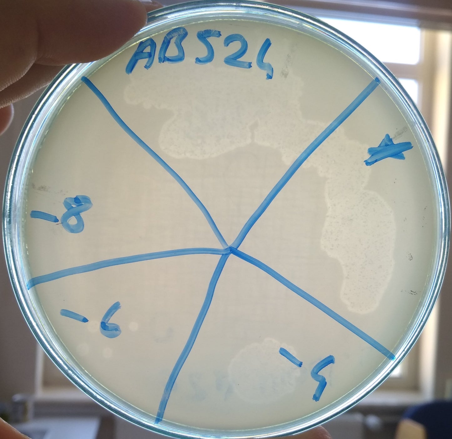 Acinetobacter baumannii bacteriophage 120524A