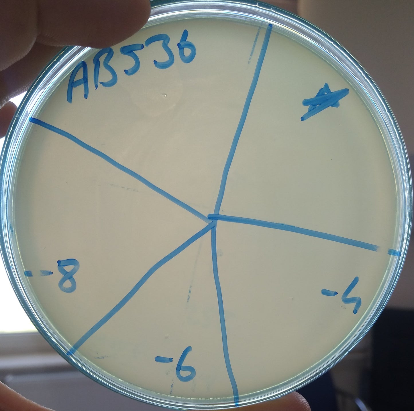 Acinetobacter baumannii bacteriophage 120536A
