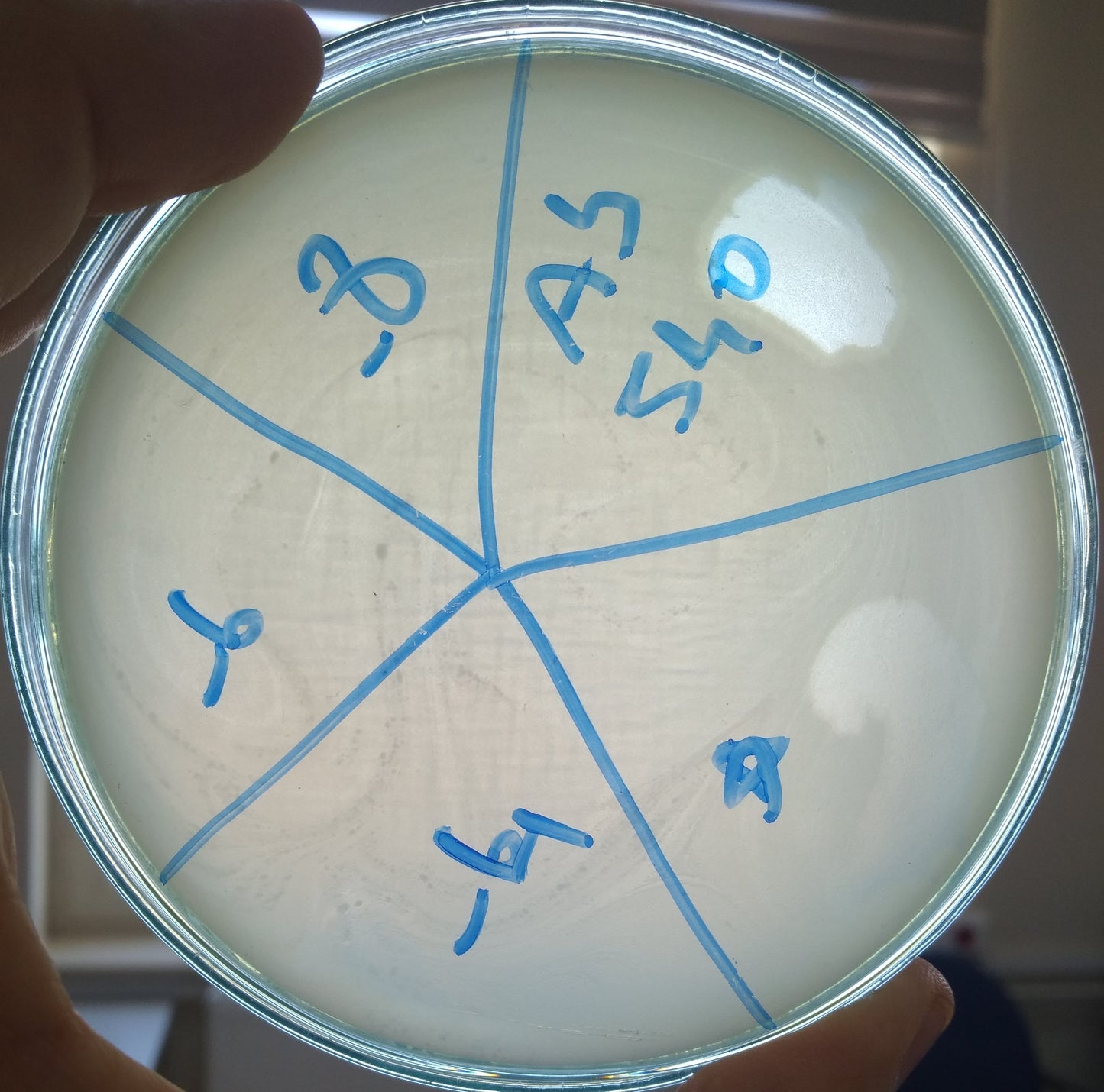 Acinetobacter baumannii bacteriophage 120540A