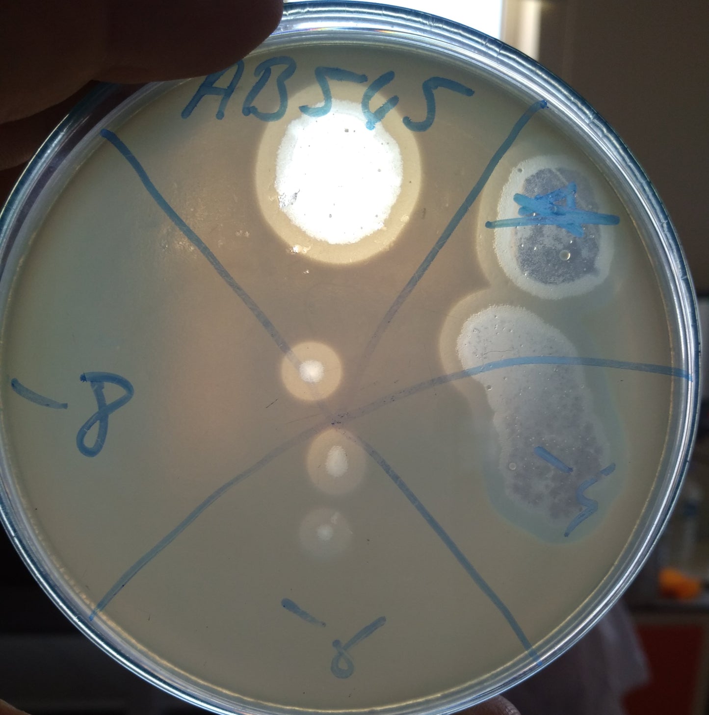 Acinetobacter baumannii bacteriophage 120545A