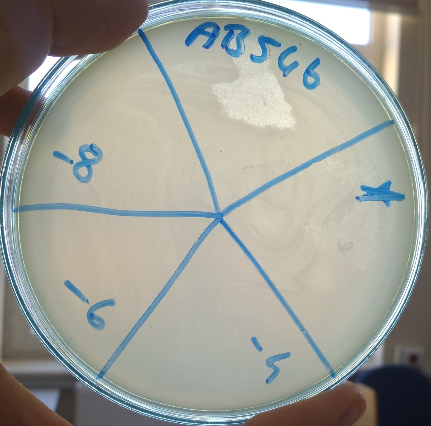 Acinetobacter baumannii bacteriophage 120546A