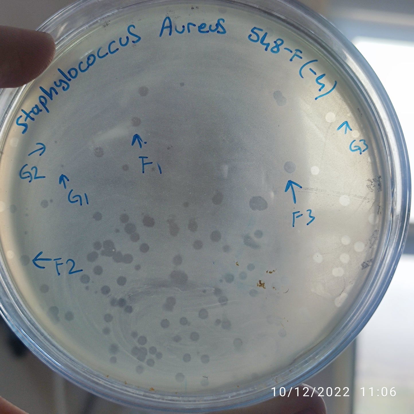 Staphylococcus aureus bacteriophage 152548G