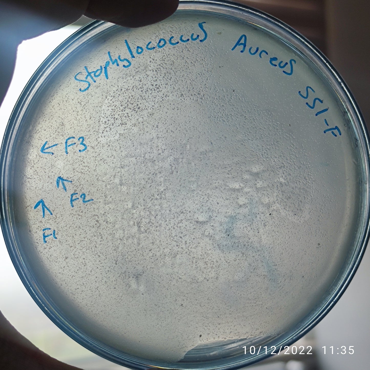 Staphylococcus aureus bacteriophage 152551F