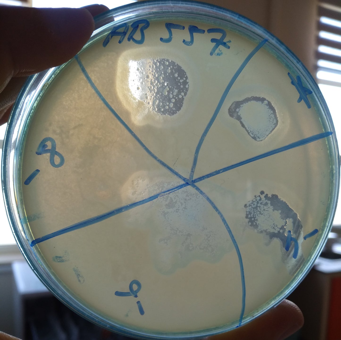 Acinetobacter baumannii bacteriophage 120557A