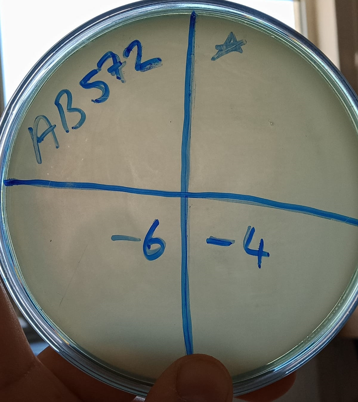 Acinetobacter baumannii bacteriophage 120572A