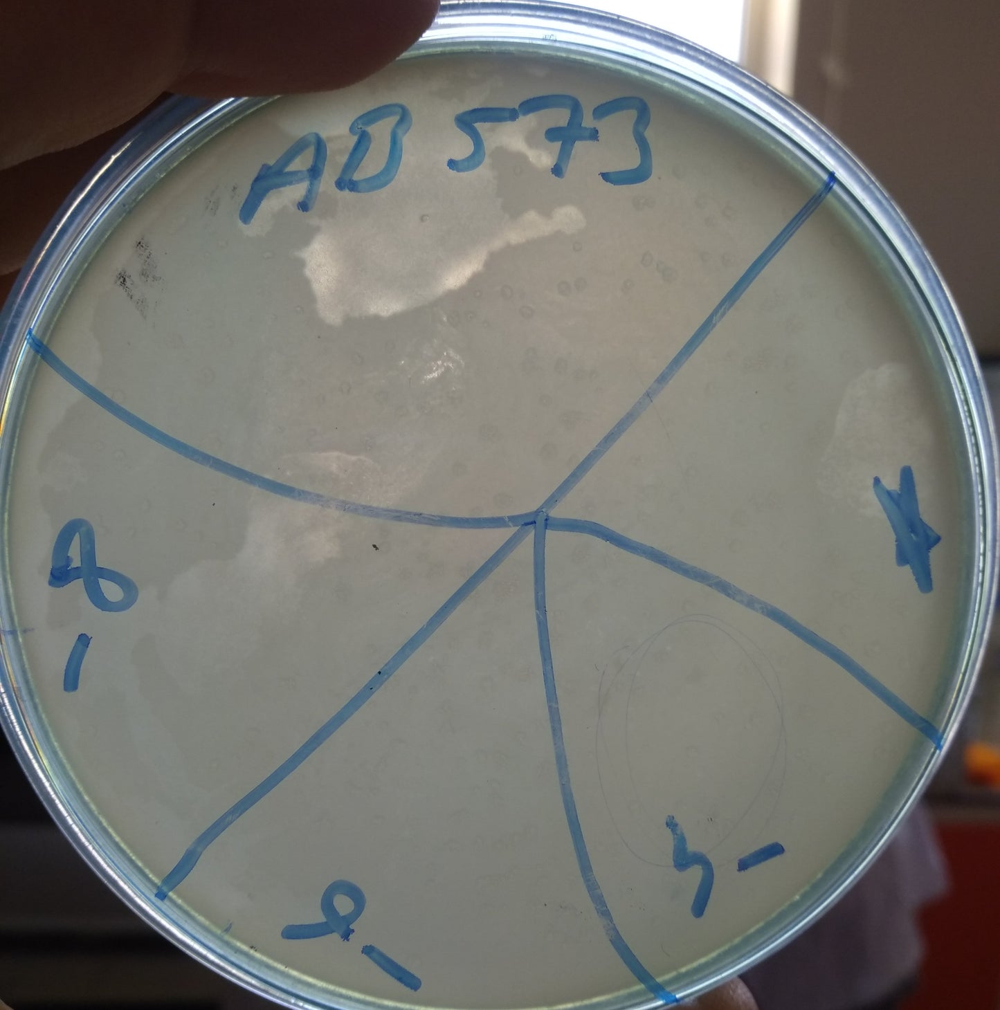 Acinetobacter baumannii bacteriophage 120573A