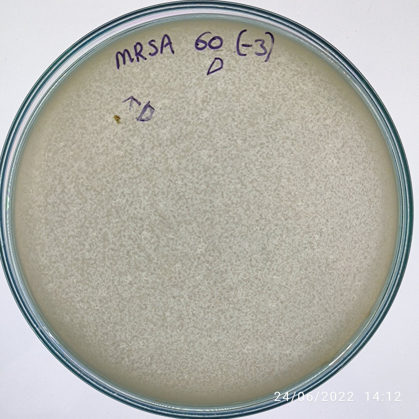 Staphylococcus aureus bacteriophage 150060D