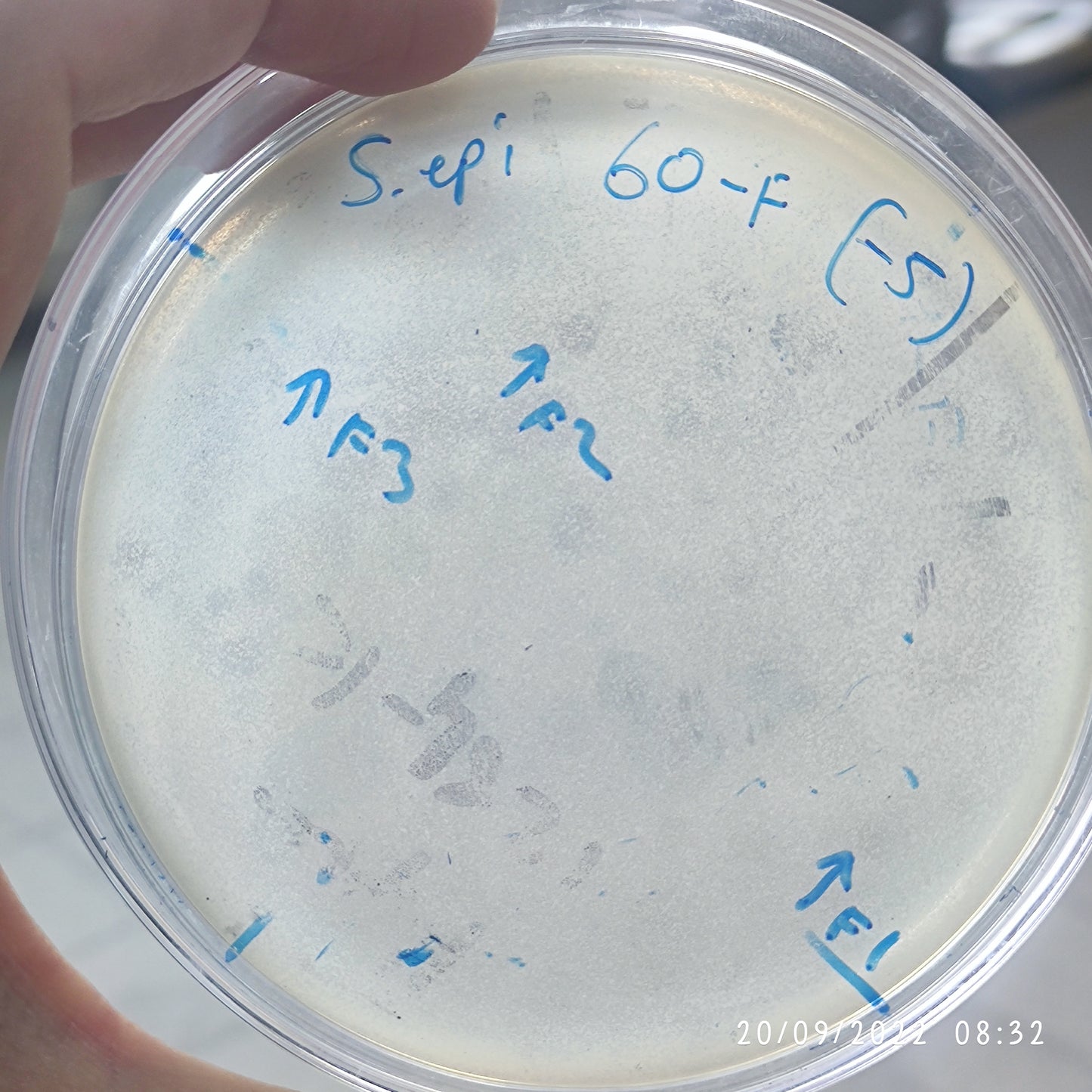 Staphylococcus epidermidis bacteriophage 158060F