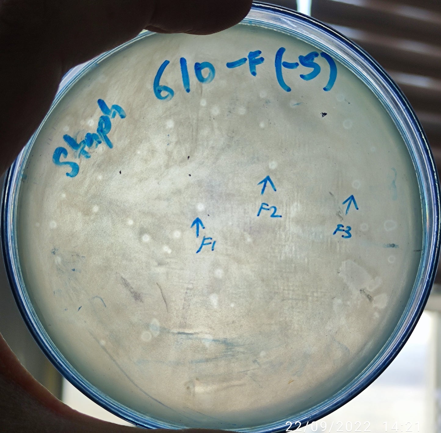 Staphylococcus aureus bacteriophage 152610F