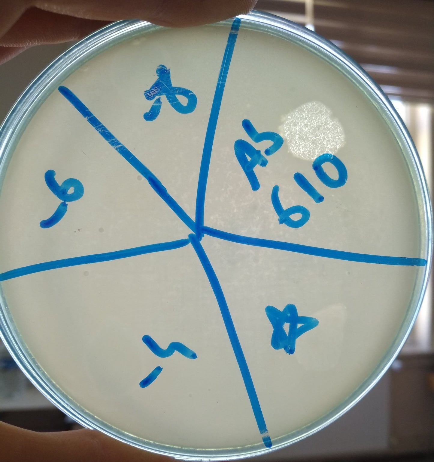 Acinetobacter baumannii bacteriophage 120610A