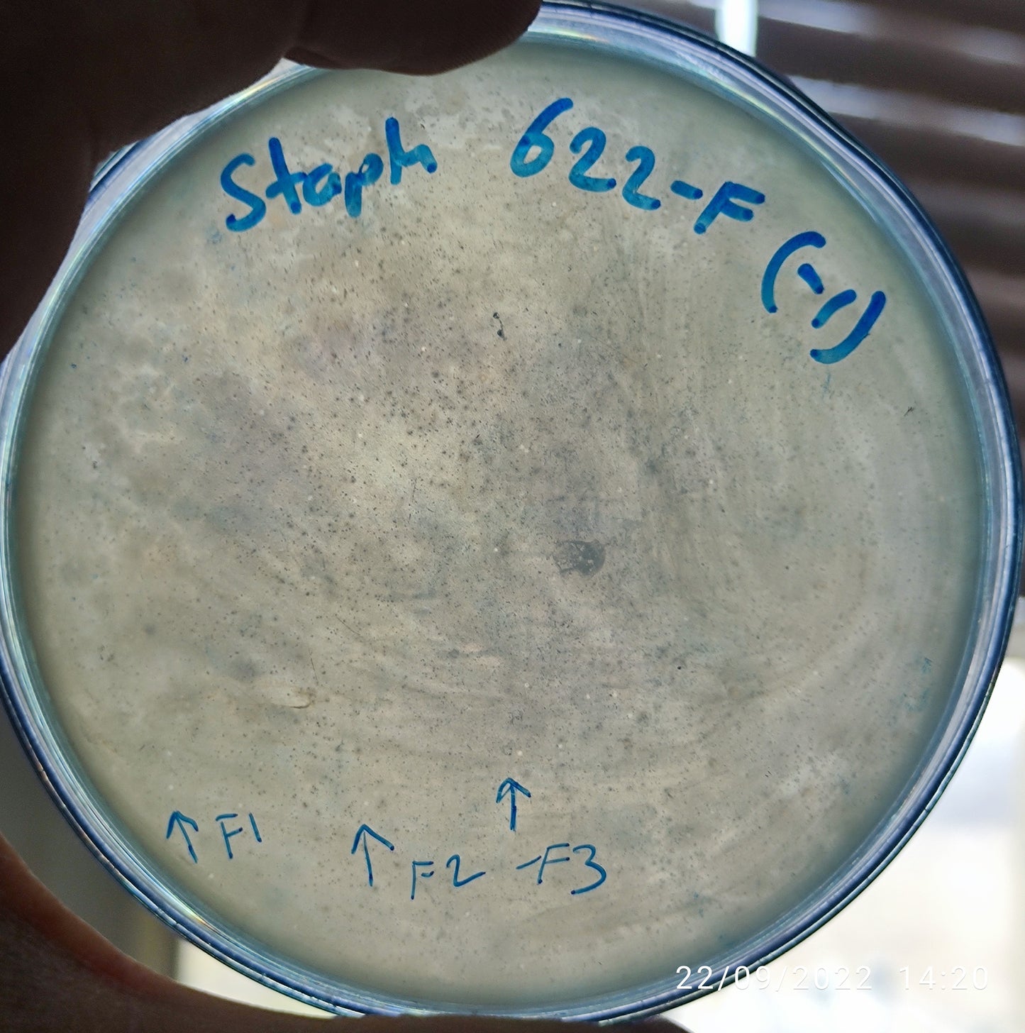 Staphylococcus aureus bacteriophage 152622F