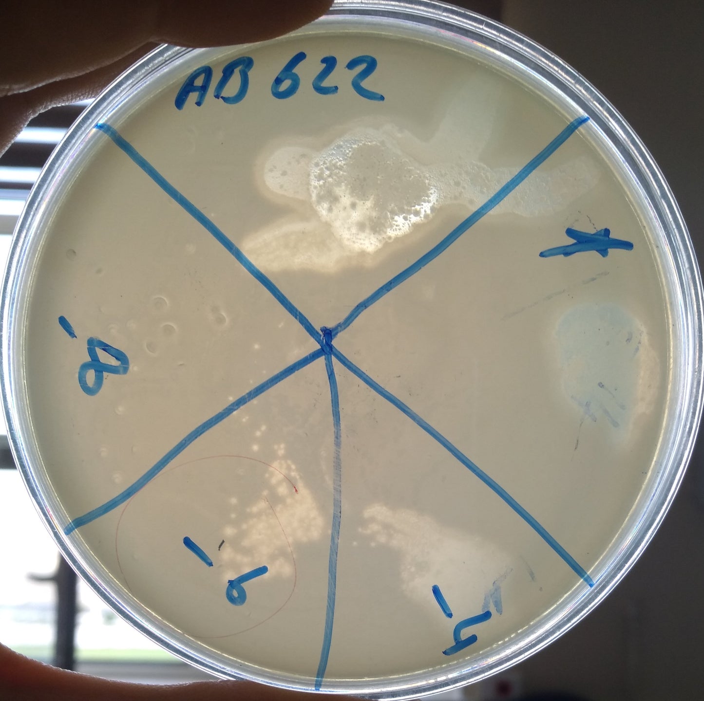 Acinetobacter baumannii bacteriophage 120622A