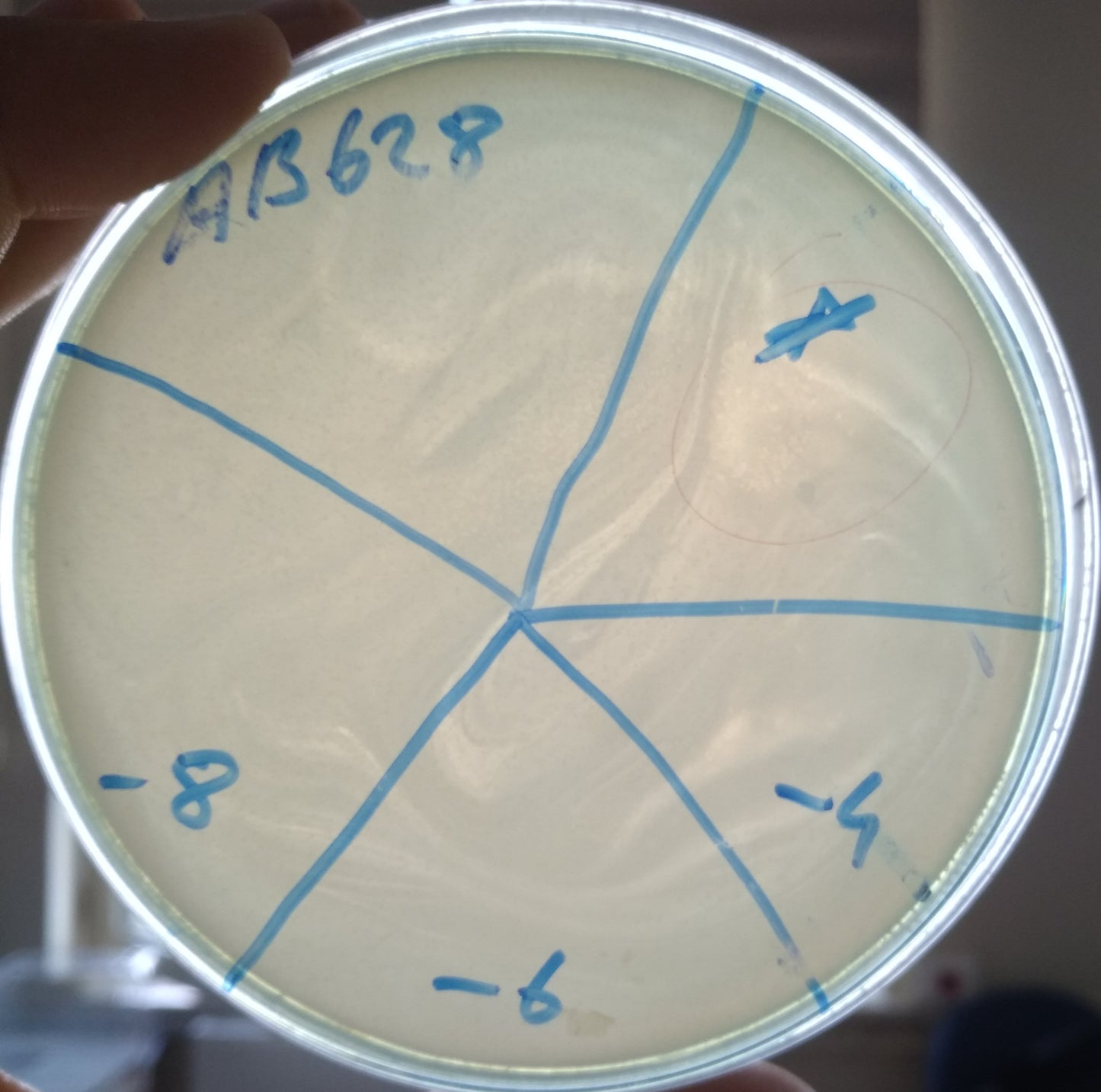 Acinetobacter baumannii bacteriophage 120628A
