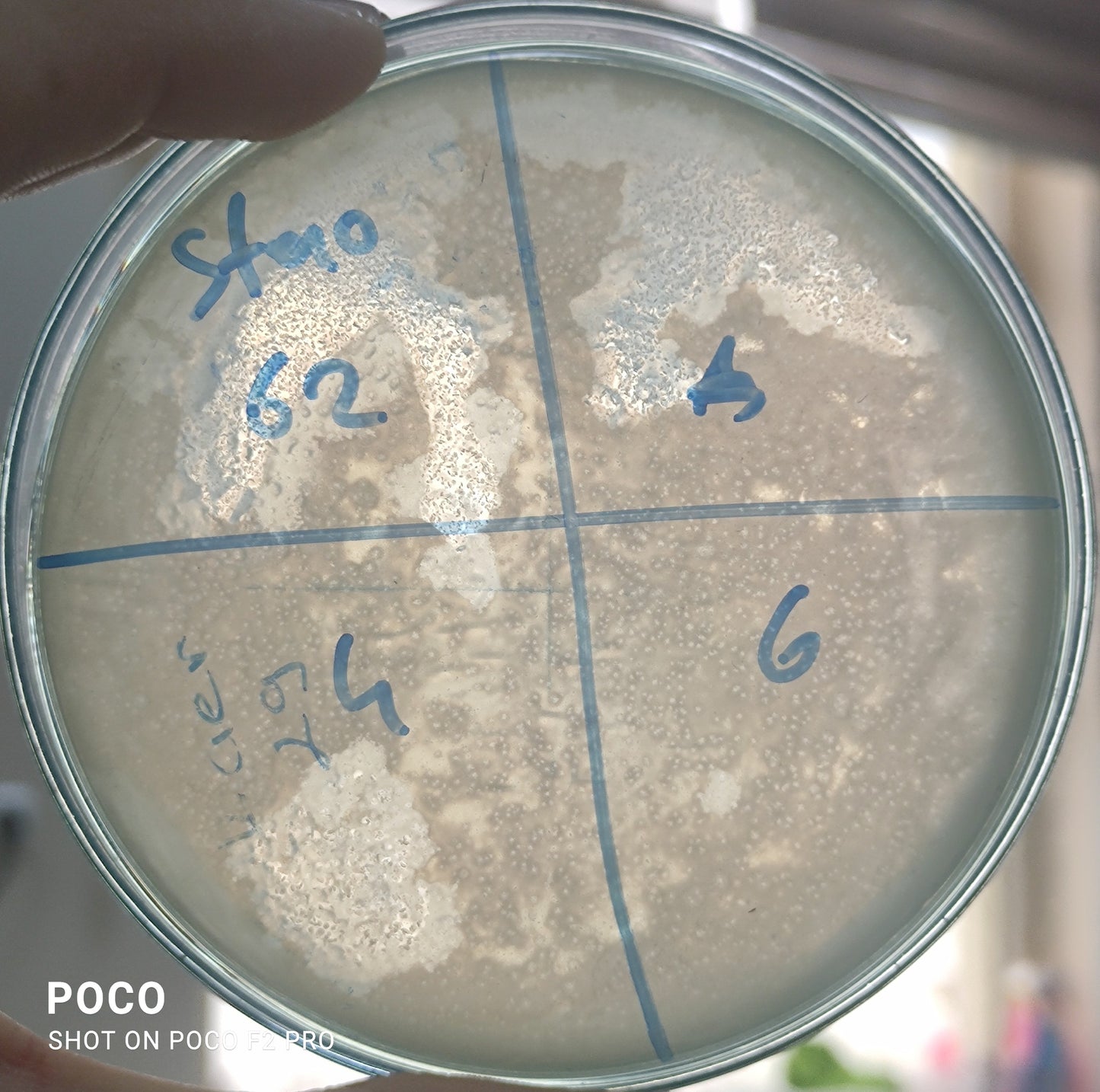 Stenotrophomonas maltophilia bacteriophage 200062D