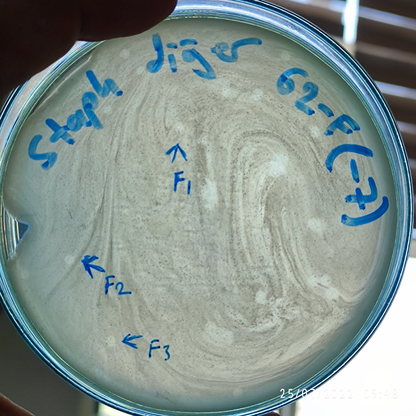 Staphylococcus epidermidis bacteriophage 158062F