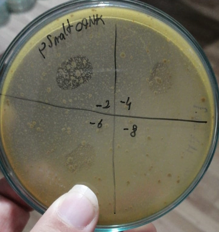 Stenotrophomonas maltophilia bacteriophage 200062A