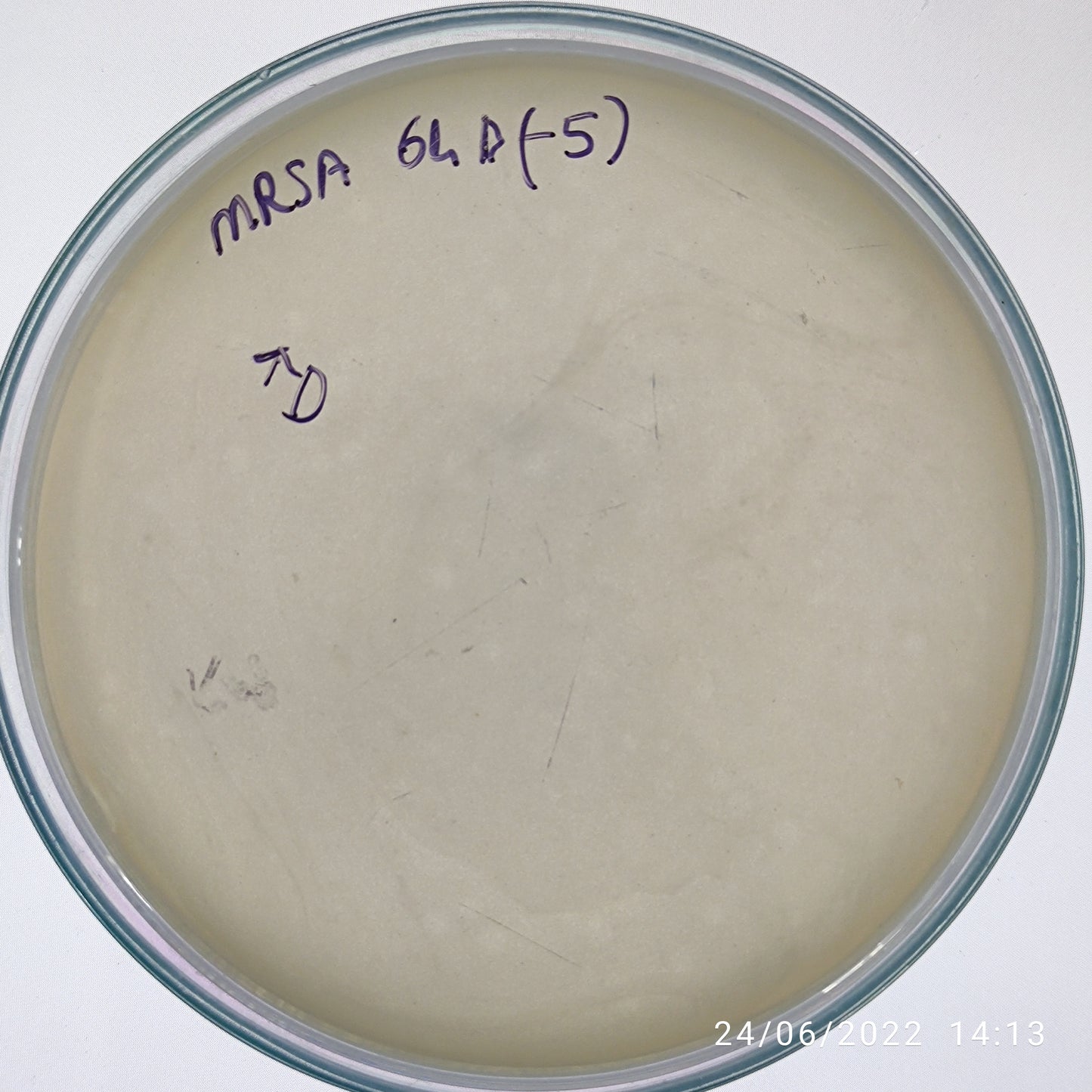 Staphylococcus aureus bacteriophage 150064D