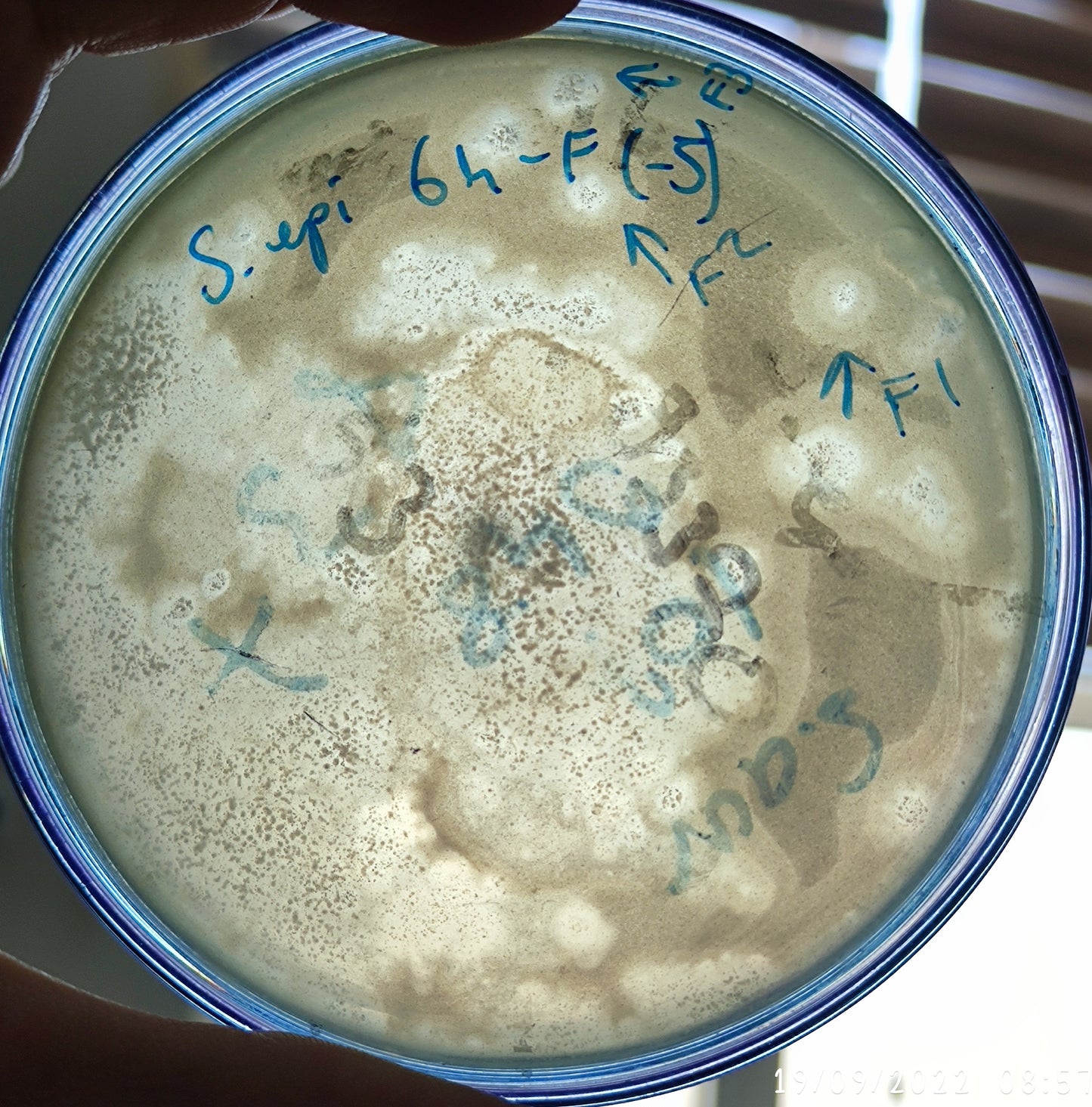 Staphylococcus epidermidis bacteriophage 158064F