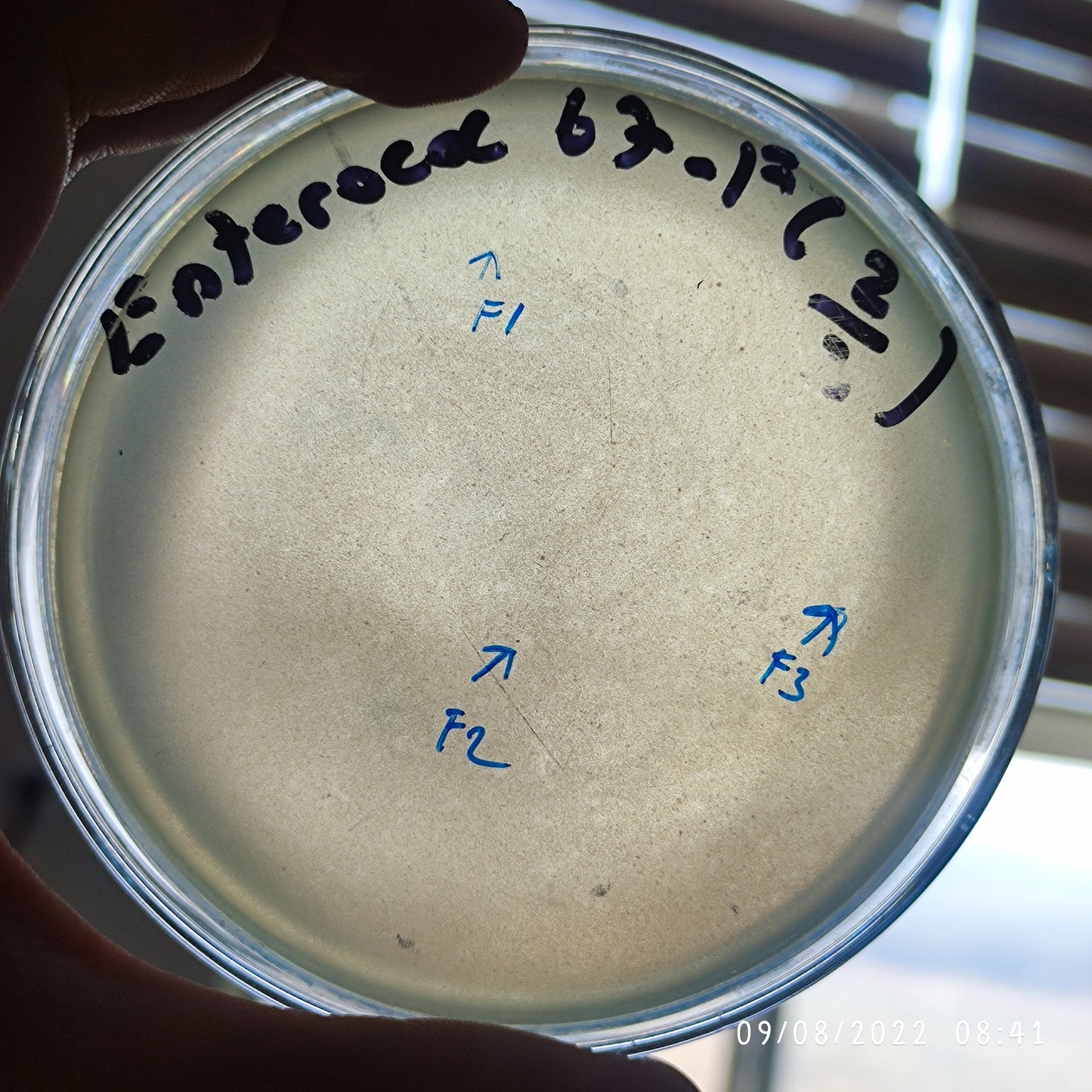 Enterococcus faecalis bacteriophage 110067F