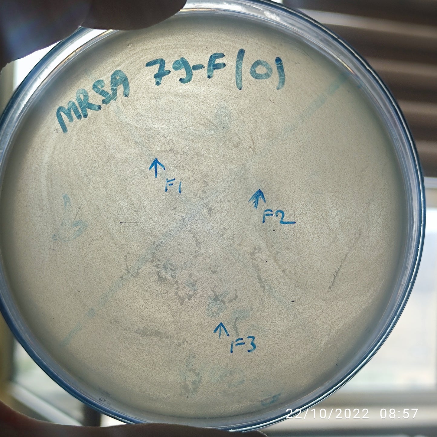 Staphylococcus aureus bacteriophage 150079F