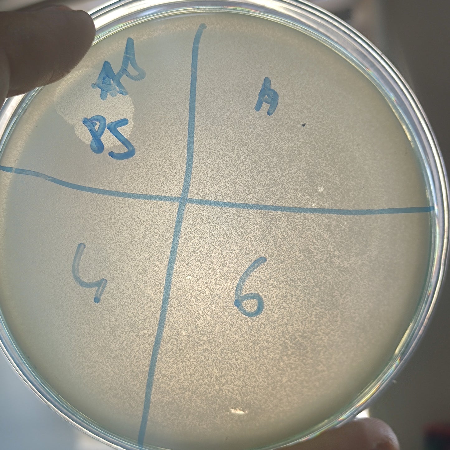 Acinetobacter baumannii bacteriophage 120085D