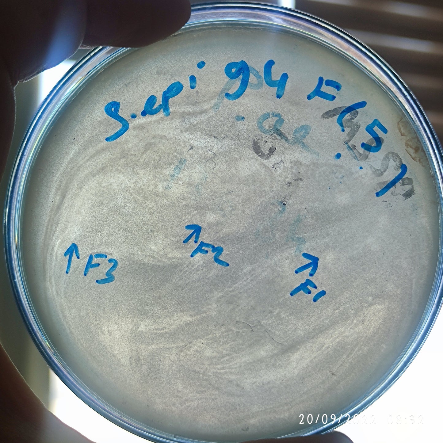 Staphylococcus epidermidis bacteriophage 158094F