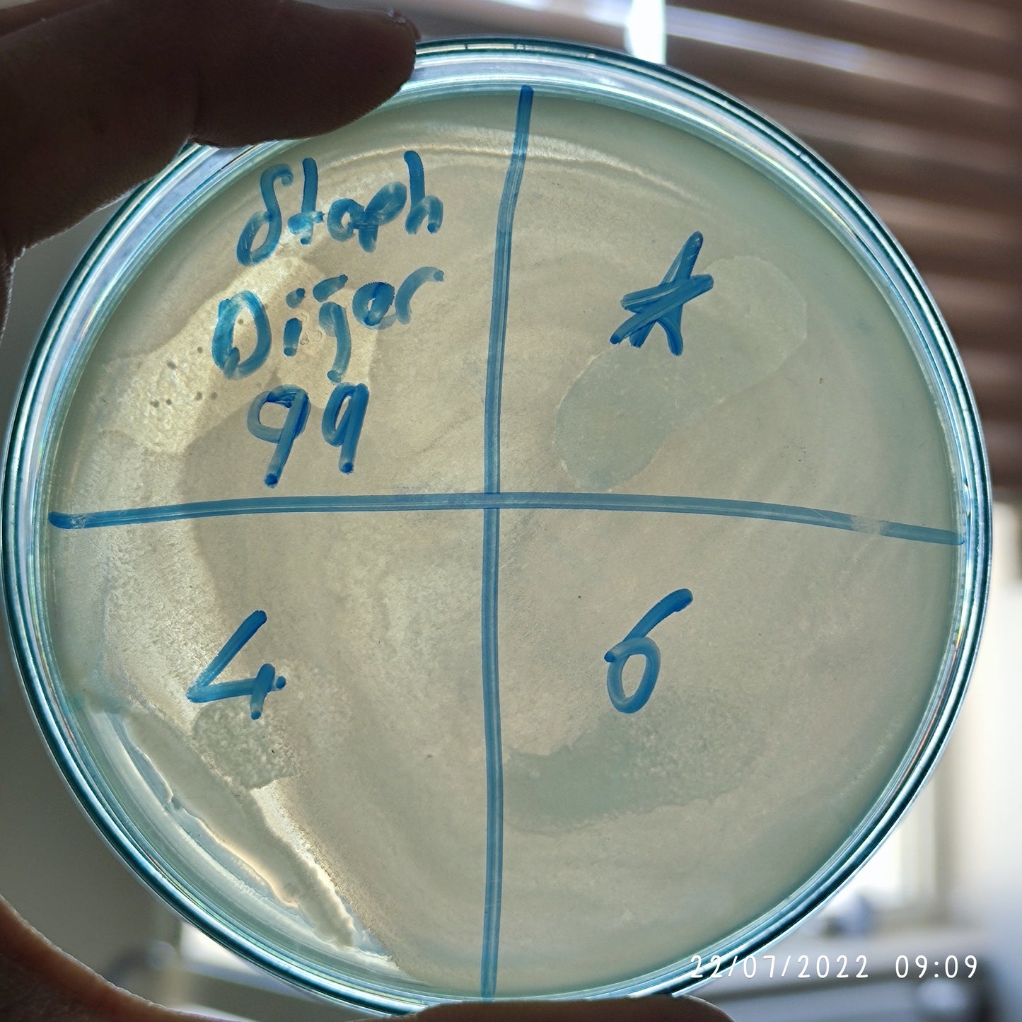 Staphylococcus epidermidis bacteriophage 158099F
