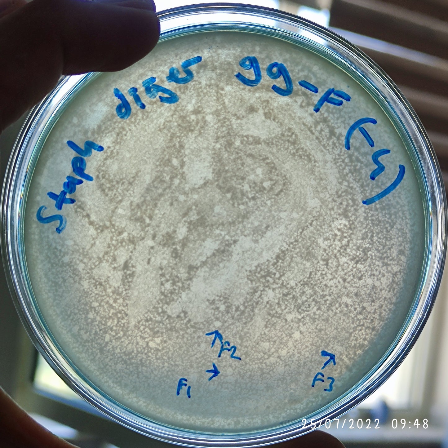 Staphylococcus epidermidis bacteriophage 158099F