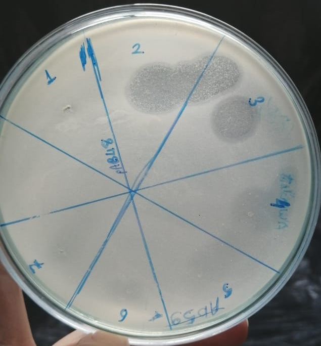 Acinetobacter baumannii bacteriophage 120048A