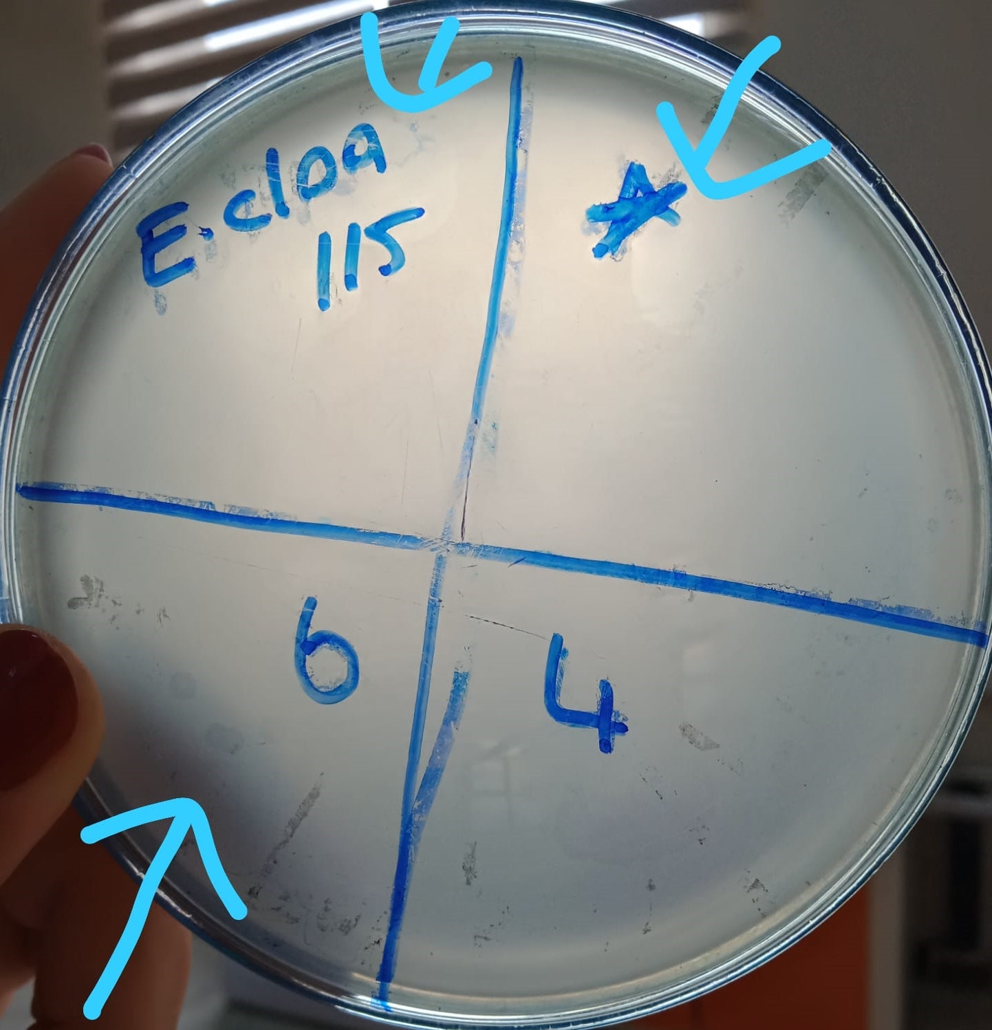Enterobacter cloacae bacteriophage 200115A
