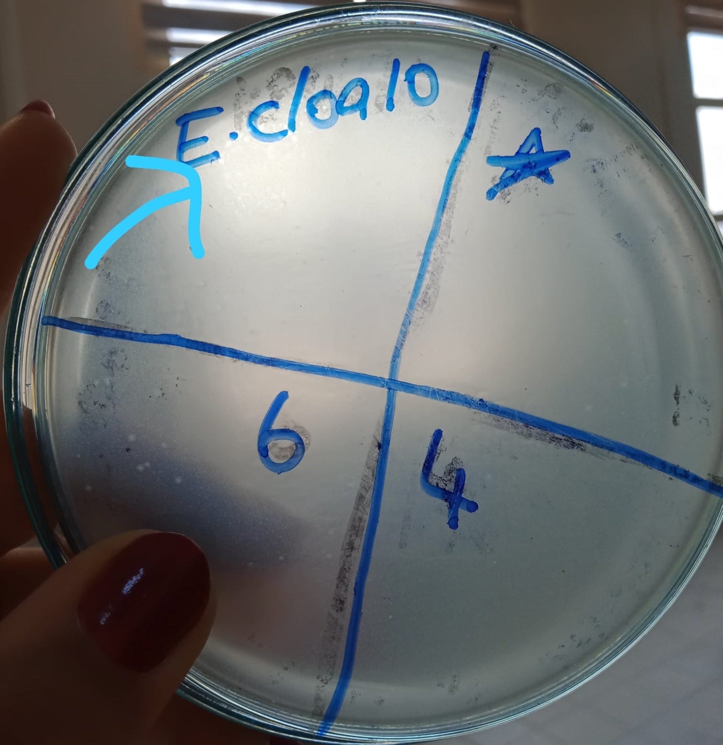 Enterobacter cloacae bacteriophage 200024A