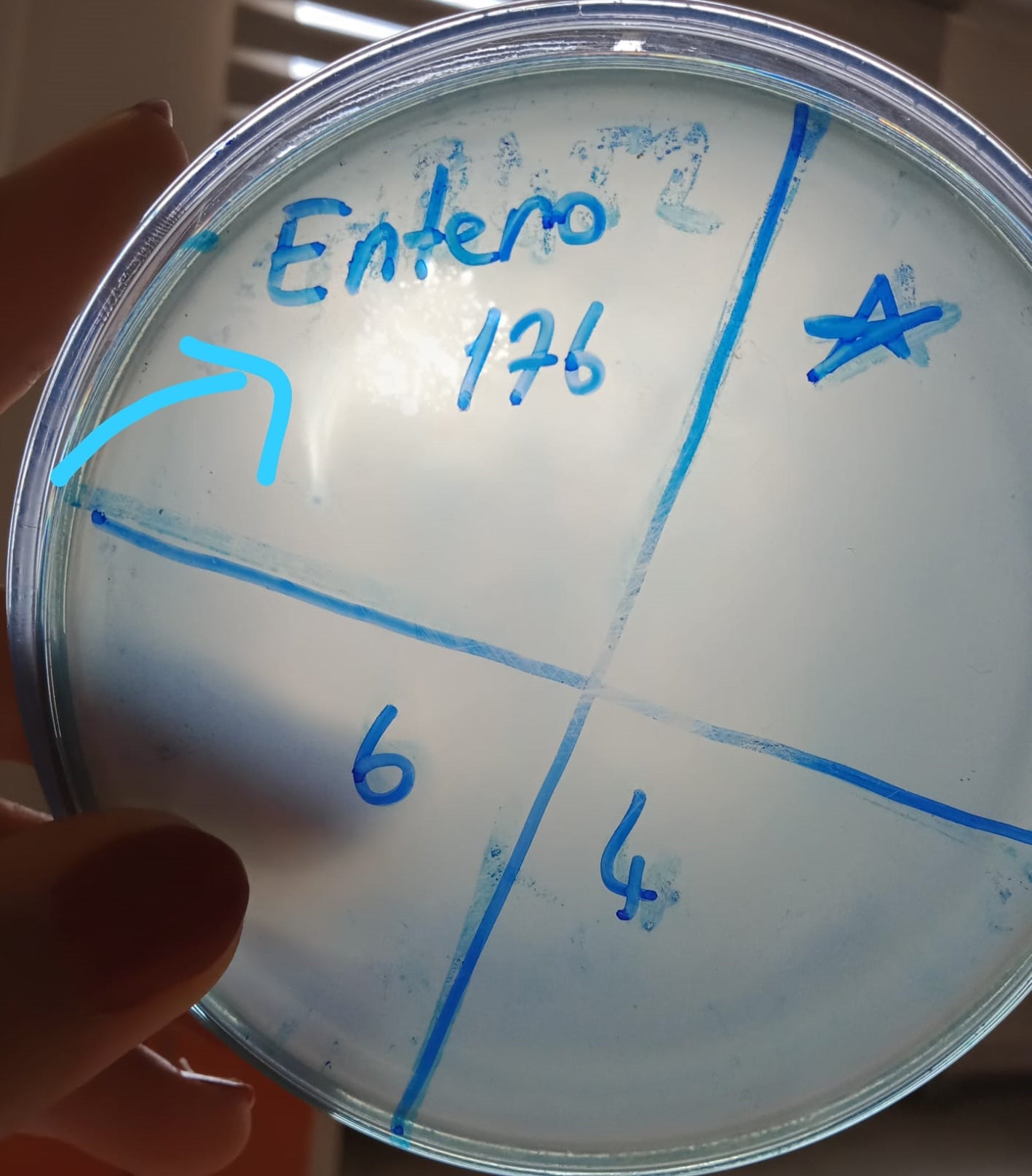 Enterobacter cloacae bacteriophage 200176A
