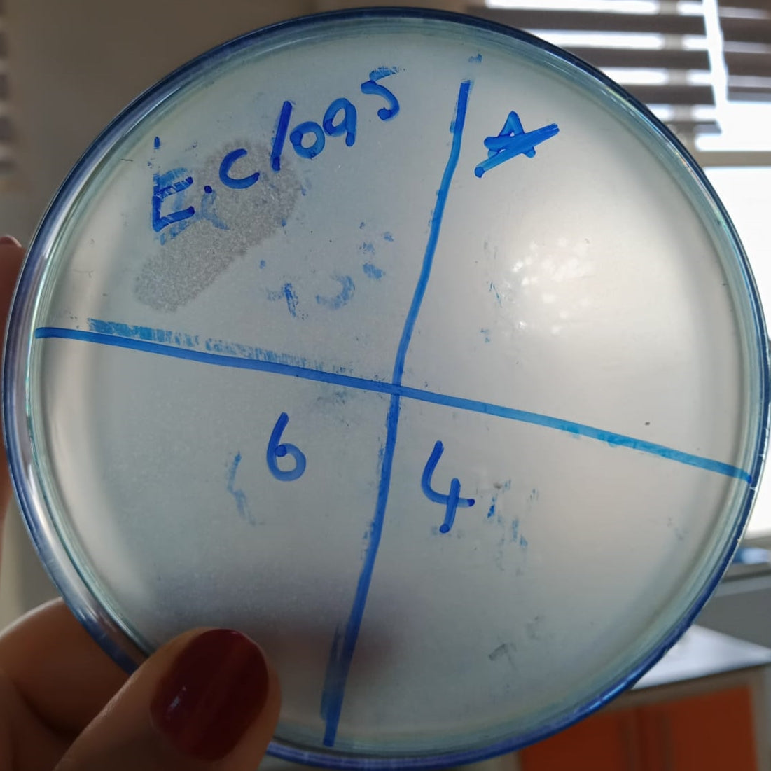 Enterobacter cloacae bacteriophage 200019A