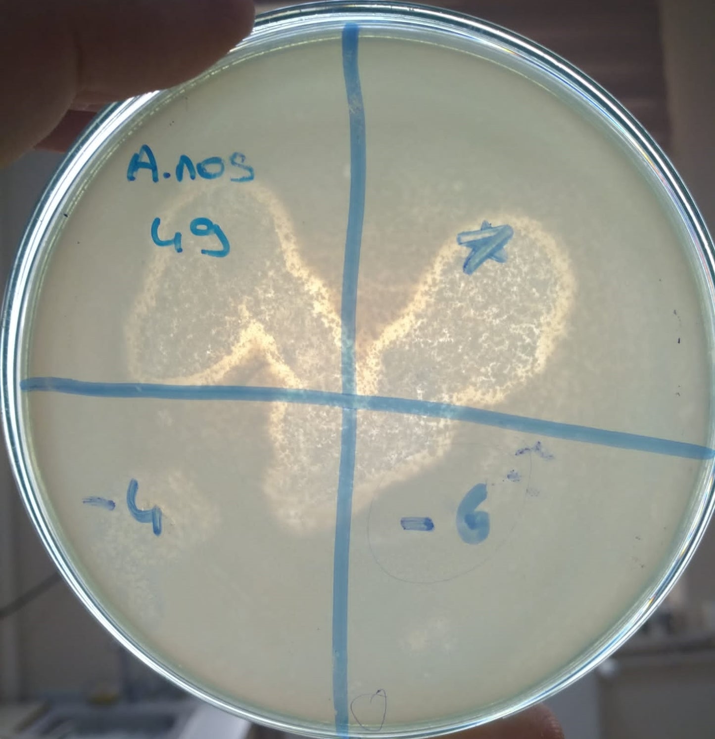 Acinetobacter nosocomialis bacteriophage 128049A