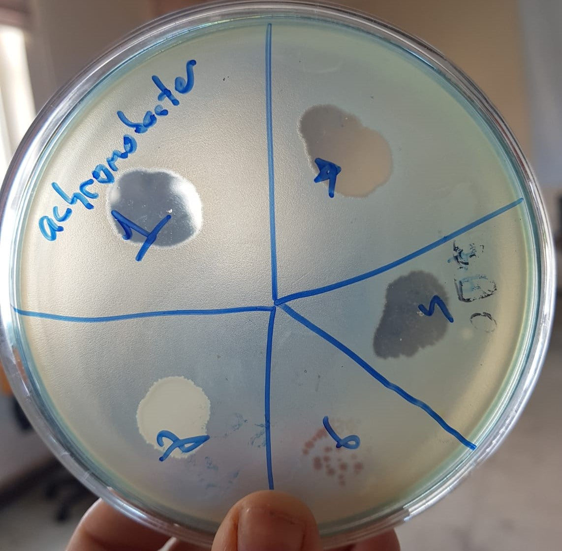 Achromobacter xylosoxidans bacteriophage 200001D