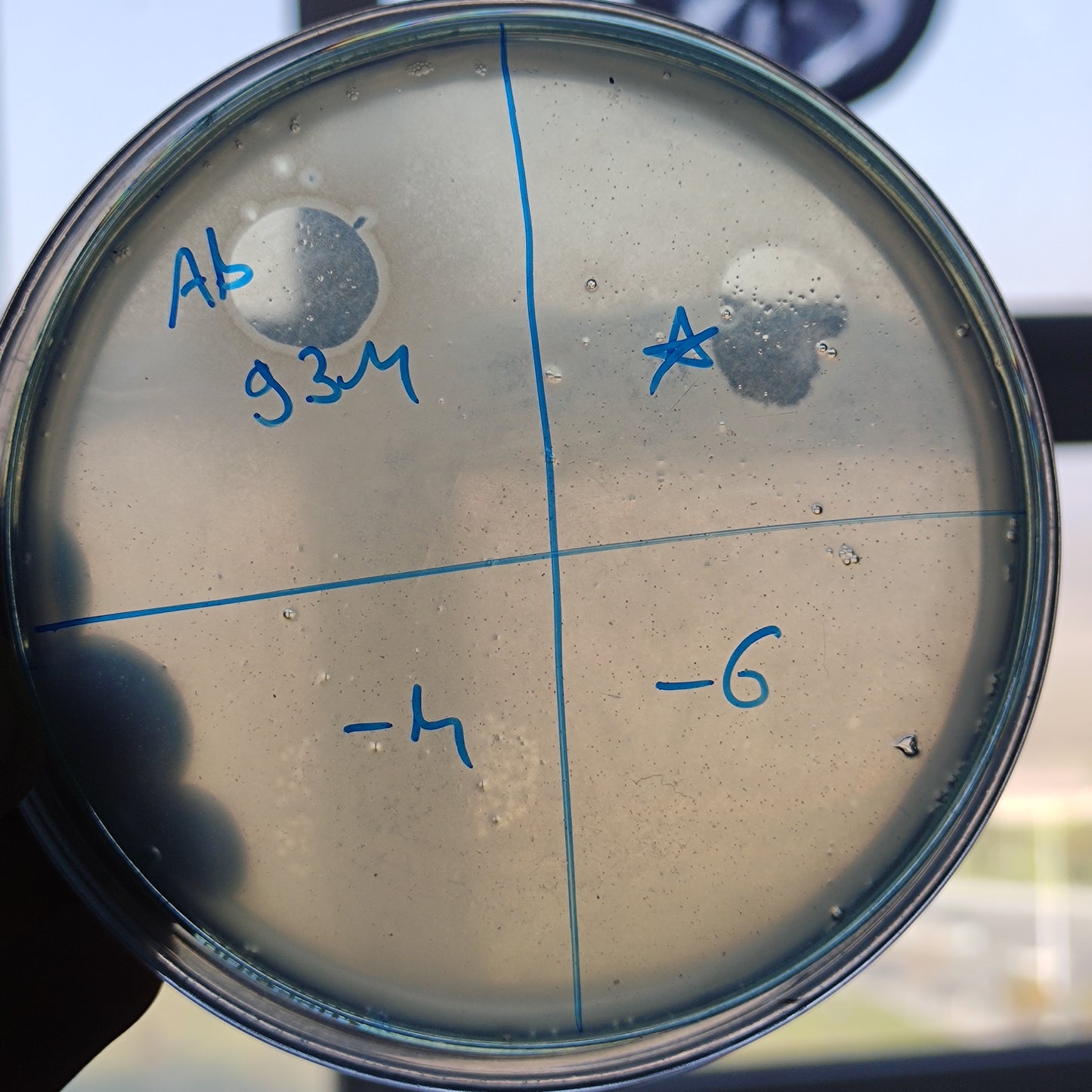 Acinetobacter baumannii bacteriophage 120093A