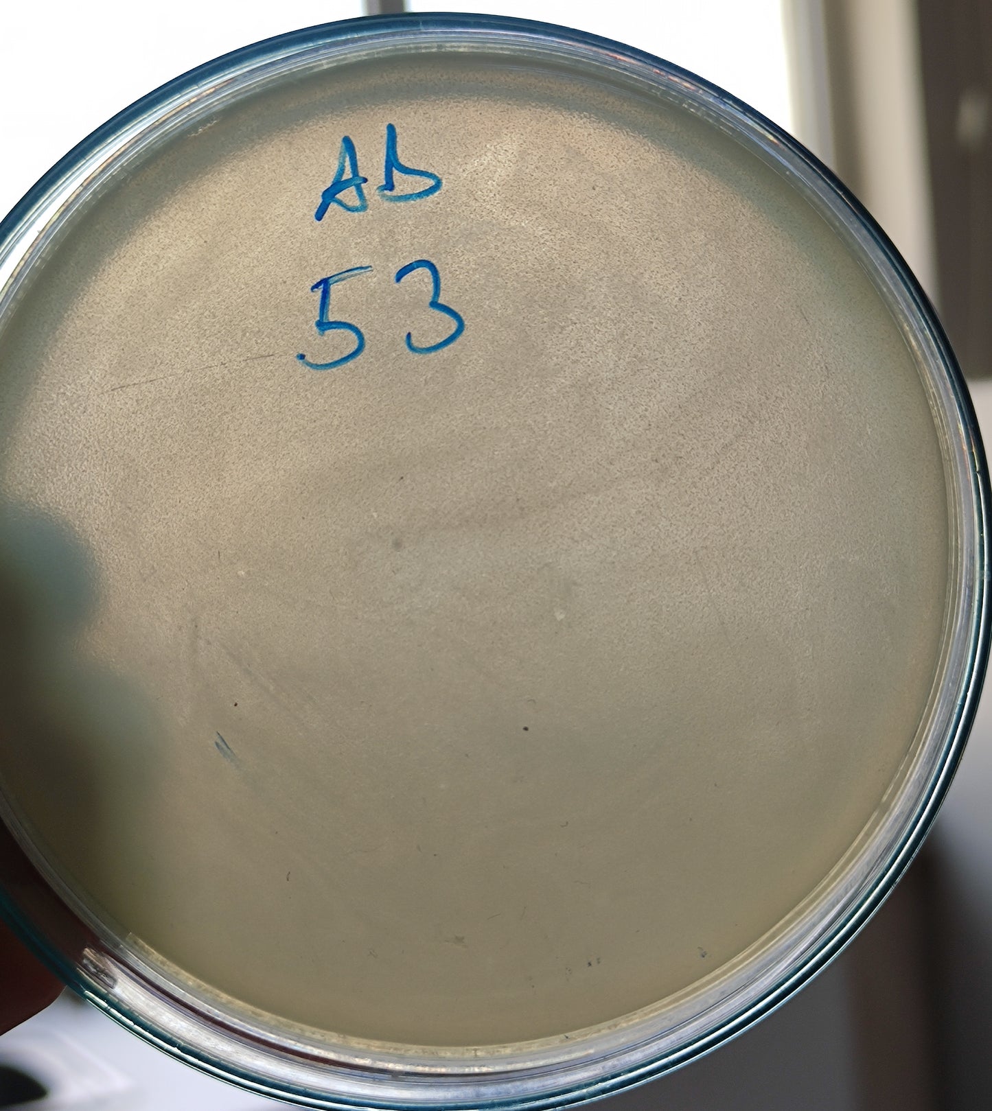 Acinetobacter baumannii bacteriophage 120053A