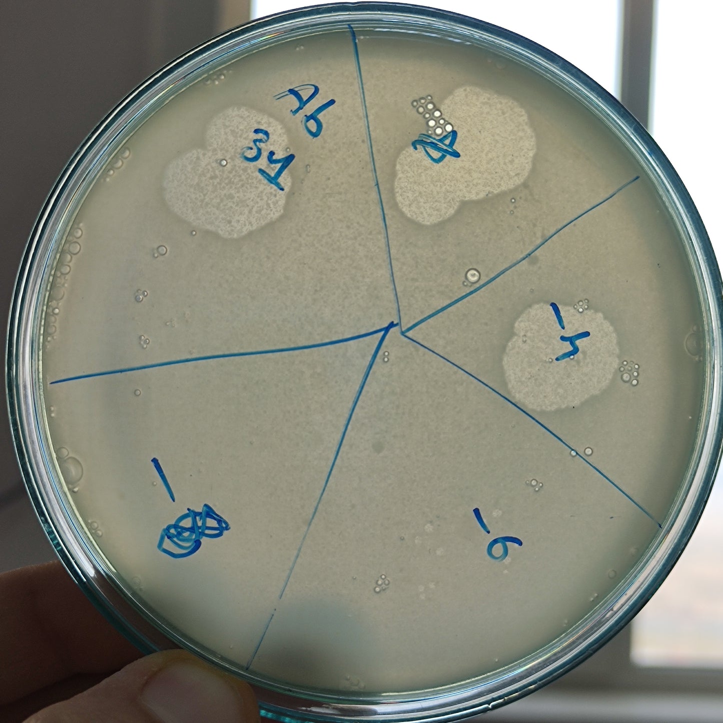 Acinetobacter baumannii bacteriophage 120031A