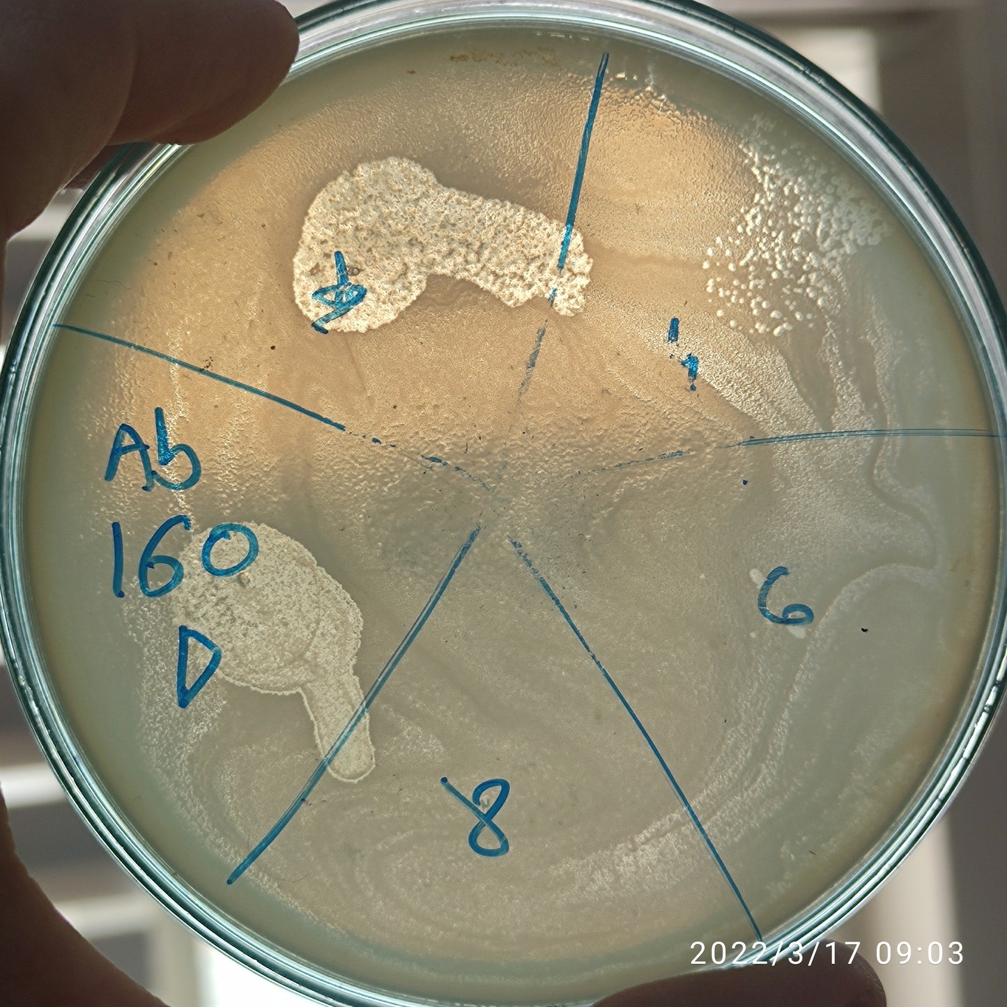 Acinetobacter baumannii bacteriophage 120160D