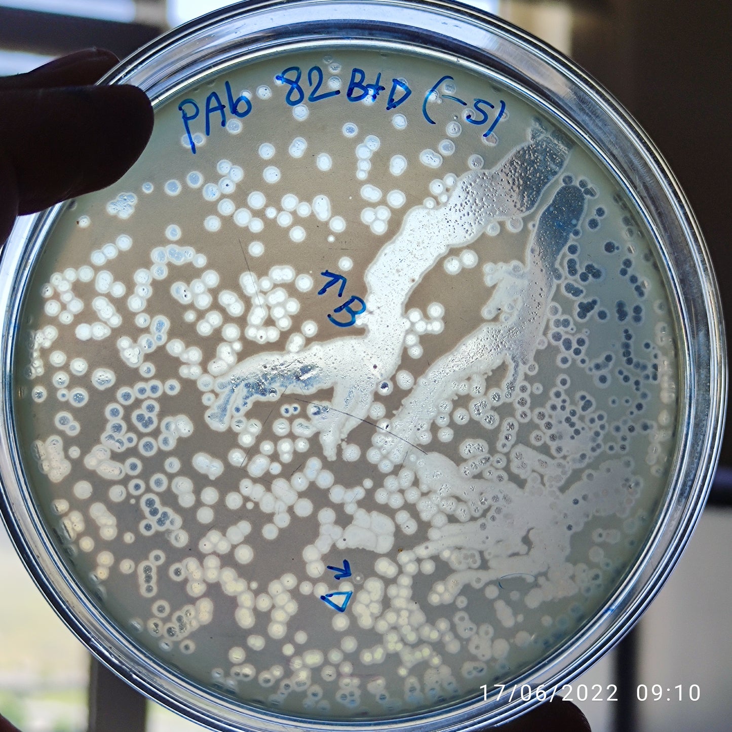 Acinetobacter baumannii bacteriophage 120082D