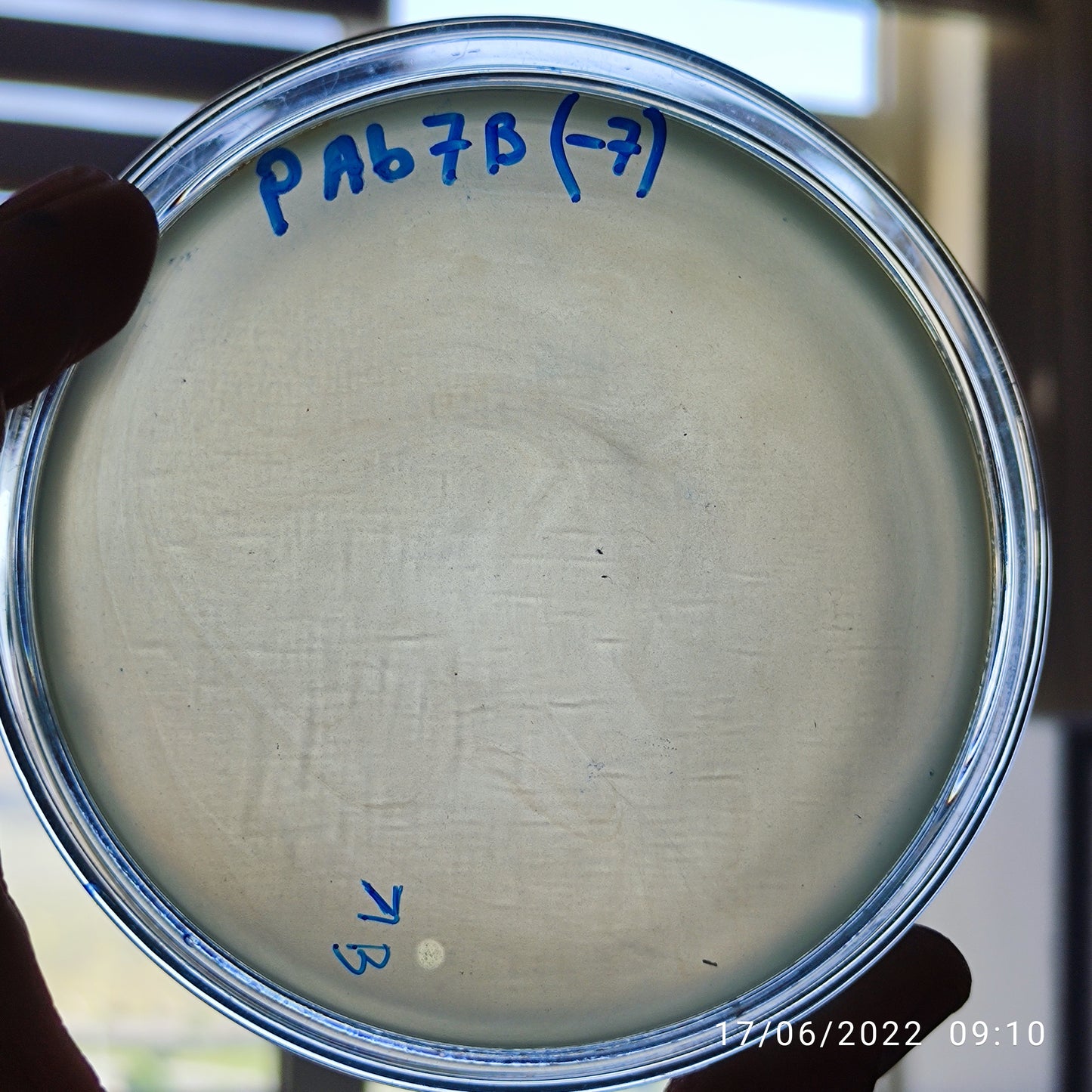 Acinetobacter baumannii bacteriophage 120007B