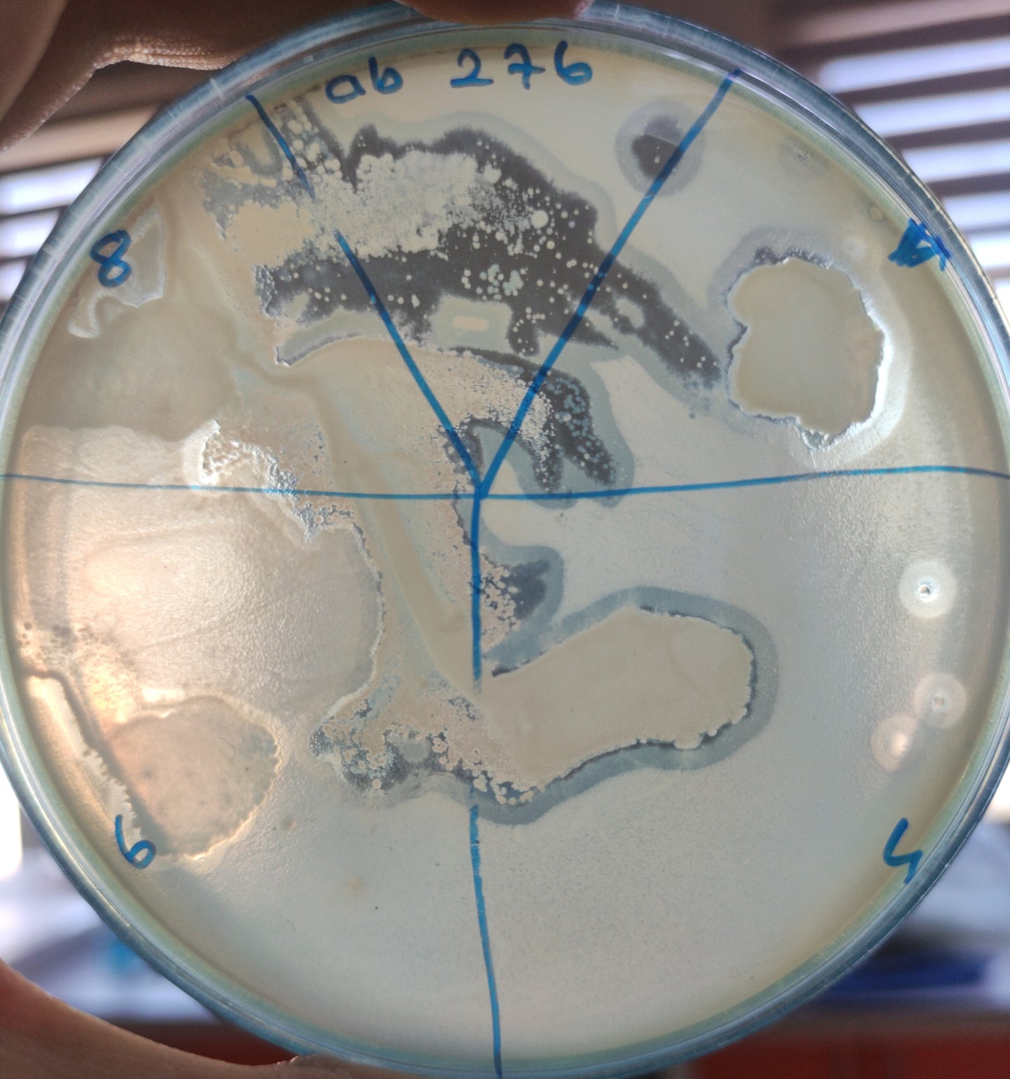 Acinetobacter baumannii bacteriophage 120276A